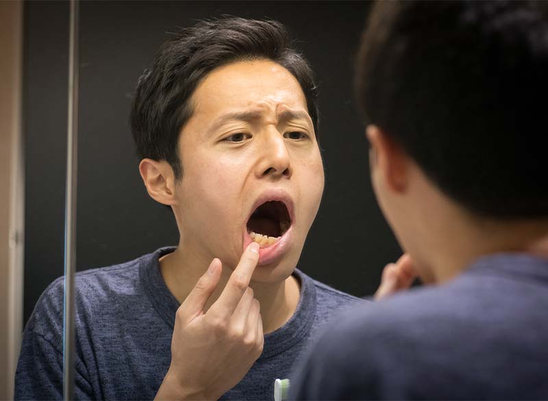 大人のむし歯の特徴